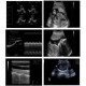 AJ-6100P     Full Digital Palm Ultrasound Scanner with Built-in Li-battery