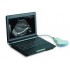 AJ-6000Plus     Full Digital Laptop Ultrasound Scanner