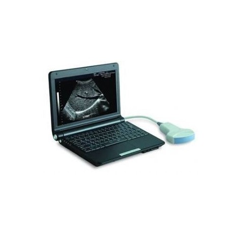 AJ-6000Plus     Full Digital Laptop Ultrasound Scanner
