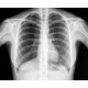 Film radiographie 35x35  BLEU NIF