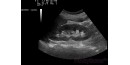 Film echographie